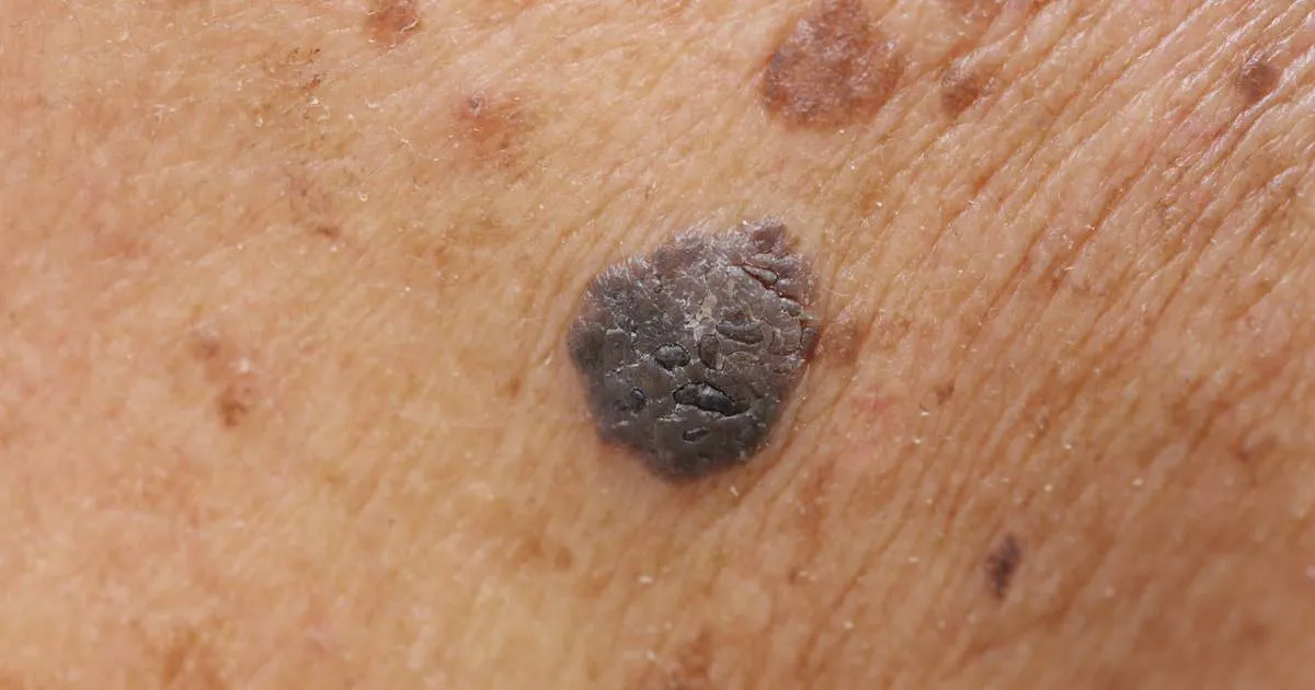 3. Förändringar på huden – kroppens yttre varningssystem